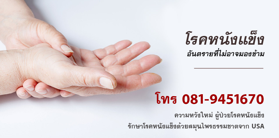scleroderma โรคหนังแข็ง อาการและการรักษา