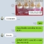 💥เซตแบ่งขาย💥 ขวดนมเด็กติดเต้า Nuk First Choice + Temperature Control 150ml Latex Teat 🇩🇪 made in Germany จุกนม Nuk จุกนมเสมือนนมแม่ ⭐️ Bottoms Set 4 ขวด