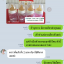 💥เซตแบ่งขาย💥 ขวดนมเด็กติดเต้า Nuk First Choice + Temperature Control 150ml Latex Teat 🇩🇪 made in Germany จุกนม Nuk จุกนมเสมือนนมแม่ ⭐️ Bottoms Set 4 ขวด
